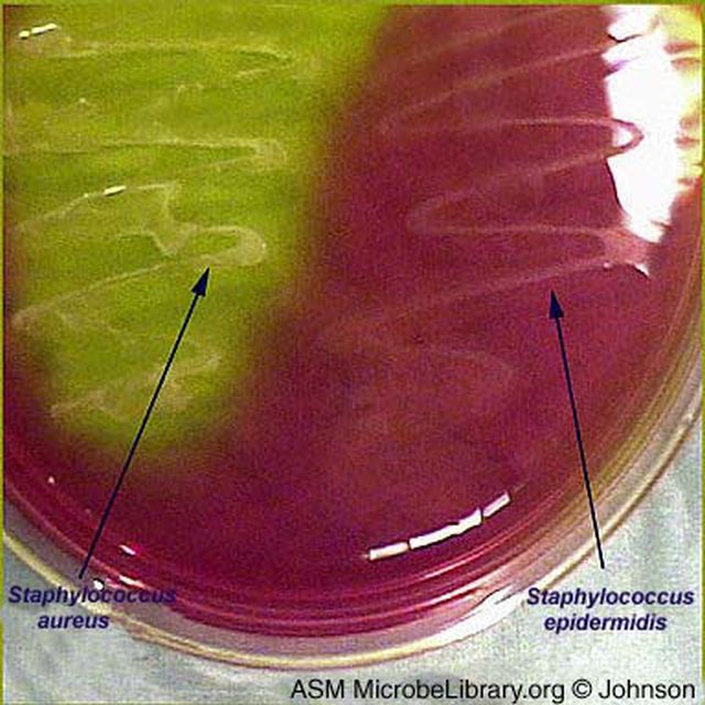 Ejemplo de cultivo bacteriano. No son huellas dactilares pero ambos son especies que pueden aparecer en la piel.