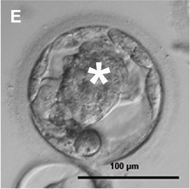 Embrión humano (Blastocisto)  obtenido gracias al núcleo de una célula adulta  in vitro (Crédito: Tachibana et al)