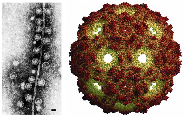 Imagen de microscopía electrónica de bacteriófagos Qβ unidos a un pilus de E. coli (tomada de Wikipedia, con una barra que corresponde a 20 nanómetros) y estructura de la cápsida viral obtenida por difracción de rayos X (Institute for Molecular Virology).