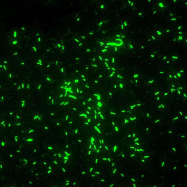 La bacteria Yersinia pestis al microscopio, gracias a la técnica de inmunofluorescencia